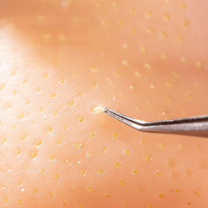 TPR Blackheads Squeezer Stress Relief Toy for Boys & Girls Ages 5-14 <b>Years</b> Black Color - Product Image 1