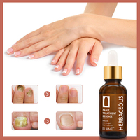 Sérum de réparation pour ongles, 1 pièce, antichampignon naturel, sérum, traitement, offre spéciale