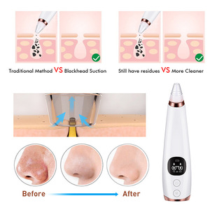 Aparato eléctrico para el cuidado de la piel, limpieza de nariz Facial, eliminación de exfoliación de cabeza negra, limpiador de poros, succión de comedón al vacío, removedor de espinillas - Product Image 3