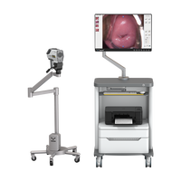IKEDA Digitales Video-Kolposkop LED Optisches Bildgebungssystem für Gynäkologische Kliniken, CE & ISO Zertifiziert