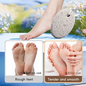 Natuurlijk Puimsteen Pedicure Tool Voor Voet Scrub Exfoliatie En Harde Huid <span class=keywords><strong>Callus</strong></span> Verwijderen <span class=keywords><strong>Callus</strong></span> Remover Bestand - Product Image 6