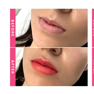 Hadurage Lip Filler Premium 2x1ml - Remplisseur dermique injectable pour les lèvres rouges, pulpeuses, hydratées et riches en couleur - Product Image 2