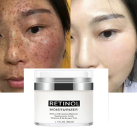 Crème Visage Herbal OEM en Gros, Blanchissante Intense, Anti-Taches de Rousseur, Mélasma, Acné, Taches Brunes, à la Niacinamide, Usage Diurne pour Femmes