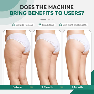 Masseur de Cellulite Portable électrique Healthpal <span class=keywords><strong>Vibro</strong></span> corps sculptant Slimimg <span class=keywords><strong>Machine</strong></span> tenue dans la main avec coussinets lavables et masseur - Product Image 6