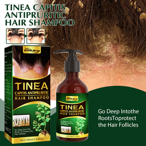 SentryMed Tinea Dispelling Capitis Champú antipruriginoso para el cabello <span class=keywords><strong>Tratamiento</strong></span> anticaspa antipicazón Control refrescante de aceite - Product Image 5