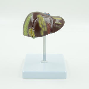 PVC病的肝臓モデルが一般的な肝および胆嚢障害を視覚化 - Product Image 3