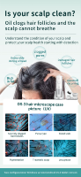 Trichoscope AI 10-200X Analyseur de Cheveux et du Cuir Chevelu 16MP Trois Spectres pour Greffe de Cheveux