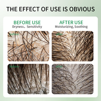 Produits de traitement des cheveux anti-chute personnalisés Sérum apaisant pour la croissance des cheveux, hydratant, shampoing, soins du cuir chevelu