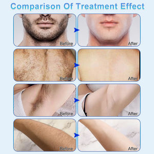 <span class=keywords><strong>Prix</strong></span> Agent : Demander des renseignements sur l'appareil d'épilation par électrolyse et aiguille de beauté, machine d'épilation avancée pour spa à domicile - Product Image 6