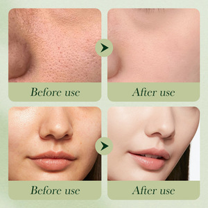 Avocat <span class=keywords><strong>beauté</strong></span> produits pour le visage et soins <span class=keywords><strong>de</strong></span> la peau personnels ensemble rajeunissant pour les femmes hydratant blanchissant la peau ensemble <span class=keywords><strong>de</strong></span> six pièces - Product Image 4