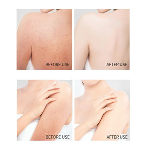 Siero Viso e Corpo all'Ingrosso 300ml con Vitamina <span class=keywords><strong>C</strong></span>, Glutatione, <span class=keywords><strong>Papaya</strong></span>, Acido Kojico, AHA, Curcuma e Alfa Arbutina - Product Image 5