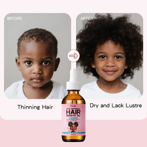 Huile Capillaire Naturelle Bio pour Enfants avec Logo Personnalisé et Marque Privée, Hydratant et Favorisant la Croissance des <span class=keywords><strong>Cheveux</strong></span> de Bébé - Product Image 4