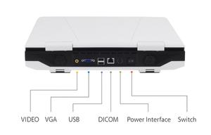 Resolusi Tinggi Tinggi terpasang 3D 4D warna <span class=keywords><strong>Doppler</strong></span> 15 inci Ecografo portatel PW <span class=keywords><strong>CW</strong></span> jantung gema mesin Ultrasound - Product Image 3