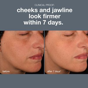 ETRUN ALISA Pro-Collagène Peptide Sérum pour le visage Marque privée Peau pompée Hydratant Raffermissant Anti-Rides pour le visage <span class=keywords><strong>Jawline</strong></span> - Product Image 2