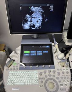 Fourniture et réparation d'écran tactile/écran LCD/moniteur pour machine à ultrasons Voluson E8/E10/E6 - Product Image 3