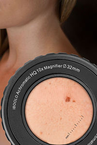 IBOOLO DE-4100 appareil de <span class=keywords><strong>dermatoscope</strong></span> photo pour dermatologie <span class=keywords><strong>dermatoscope</strong></span> polarisé smartphone Dermoscope - Product Image 3