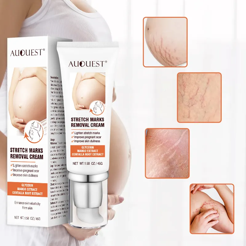 Fast Stretch Marks Removal Maternity Scar Acne Remover for Pregnant Women Anti-Aging Skin Firming Cream Body Care