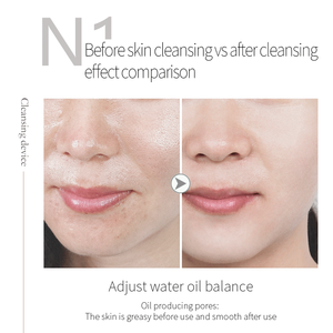 Máquina de Belleza Facial N1 Simple Models de Bajo Precio, Limpiador Facial de Burbujas Mágicas, Dispositivo de Limpieza con Burbujas de Oxígeno, Cuidado Básico de la Piel - Product Image 4