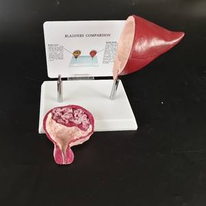 Comparación de Órganos Viscerales Normales con Corazón, Pulmón, Vejiga, Vasos, Tráquea Oral, Modelo Médico Fetal - Product Image 4