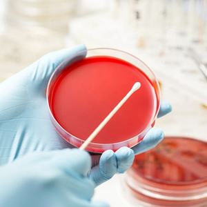 Monouso in plastica Sterile 90x15mm 9cm da laboratorio utilizzare capsule di <span class=keywords><strong>Petri</strong></span> trasparenti per biologico - Product Image 2