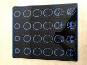 طابعة أفلام التصوير الطبي عالية الجودة لمعدات الأشعة وملحقات نظام د - Product Image 6