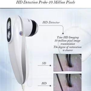 Analizzatore Cutaneo da 15 Pollici, Rilevatore di Peli e Cuoio Capelluto ad Alta Definizione, Tester per la Rimozione di Pigmenti, Strumento Diagnostico per la Cura della Pelle 50X/200X a 2 Lenti - Product Image 3