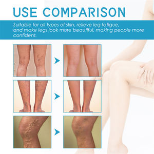 Batı Ay Varisli Damarlar İçin Onarıcı Krem Besleyici Yatıştırıcı Nemlendirici Çin Malı Varis Kremi - Product Image 5