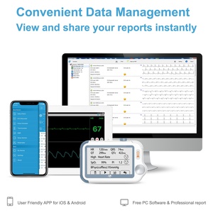 Viatom-Monitor de signos vitales <span class=keywords><strong>para</strong></span> el hogar, Mini medidor de <span class=keywords><strong>glucosa</strong></span> con sonda Spo2, dispositivos de monitoreo de señal Vital, Bluetooth - Product Image 2