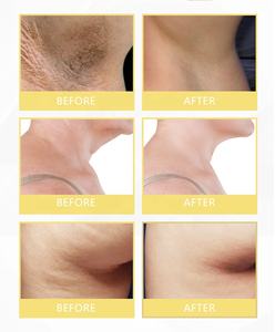 ครีมทารักแร้ดำ,ครีมทารักแร้หน้าขาวผิวสว่าง - Product Image 6