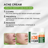 OEM ODM crème anti-acné à l'acide salicylique de haute qualité pour peaux grasses formule de contrôle de l'huile réduit les pores prévient l'aloe vera