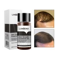 LANBENA — huile essentielle de croissance des cheveux, sérum de traitement contre la chute des cheveux, organique, gingembre