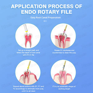 F TAPER GOLD歯科ロータリーファイル根管治療用ゴールドロータリー波ファイル1つのみ - Product Image 5