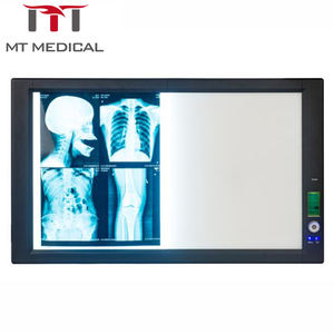 Visualizzatore di pellicole mediche MT MEDICAL di alta qualità, ultra sottile, a doppio <span class=keywords><strong>LED</strong></span>, per raggi <span class=keywords><strong>X</strong></span>, con controllo digitale completo. - Product Image 2