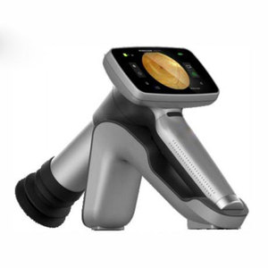 กล้องเรติน่าแบบมือถืออุปกรณ์ด้านจักษุวิทยา - Product Image 1