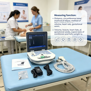 Échographe Doppler numérique 3D 4D complet sur chariot, <span class=keywords><strong>portable</strong></span>, pour usage médical humain, avec scanner intégré pour ordinateur <span class=keywords><strong>portable</strong></span> - Product Image 4
