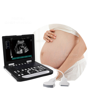 MT medis B/W pemindai <span class=keywords><strong>Ultrasound</strong></span> <span class=keywords><strong>Digital</strong></span>, pemindai <span class=keywords><strong>Ultrasound</strong></span> <span class=keywords><strong>Digital</strong></span> untuk manusia dan vet Laptop sistem <span class=keywords><strong>Ultrasound</strong></span> untuk Diagnosis - Product Image 3