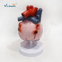 Modèle de conduction cardiaque 3 fois plus grand avec 5 parties modèle de coeur humain anatomique éducation organe du corps humain