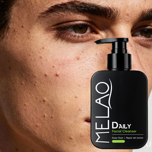 Nettoyant pour le visage avec étiquette personnalisée pour peaux à tendance acnéique Meilleur nettoyant pour le visage des hommes pour une peau éclatante - Product Image 1