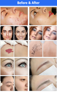 Xách tay Beauty Salon mặt làm sạch bàn chải cụ thể cho tái tạo da & làm trắng trẻ hóa máy - Product Image 5