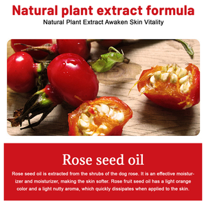 OEM/ODM Vitamine C Vergetures Acné Cicatrice Éclaircissant Blanchiment <span class=keywords><strong>Anti</strong></span>-âge Huile de Rose Musquée Soins de la Peau Sérum <span class=keywords><strong>Visage</strong></span> Bouteille 30ml - Product Image 2