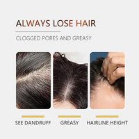 Shampo Organik 100% Pretty Cowry Label Pribadi Grosir, Perawatan Jahe, Perbaikan, Anti Gatal, Perawatan Rambut, Anti Rontok