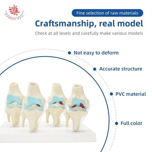 Artrose Kniegewricht <span class=keywords><strong>Model</strong></span> Frt033 Levensgrote Transparante Ligament 4 Stadium Pathologische Ontwikkeling Medisch Anatomisch <span class=keywords><strong>Model</strong></span> - Product Image 2