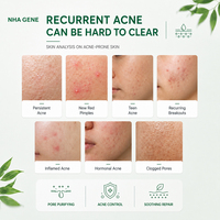 Crema para el Acné con Ácido Salicílico de Marca Privada, Tratamiento BHA, Control de Poros, Eliminación de Puntos Negros, Equilibrio de Grasa, Ácido Azelaico, Limpiador de Piel