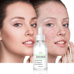 Suero Facial para el Cuidado de la Piel de 30 ml, Elimina el Acné Profundo, Aclara la Piel, con 2% de Ácido Salicílico - Product Image 1