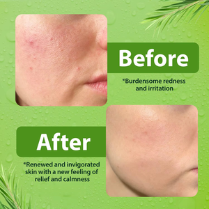 Nettoyant <span class=keywords><strong>visage</strong></span> doux OEM pour hommes et femmes, nettoyant facial hydratant pour l'<span class=keywords><strong>eczéma</strong></span>, le psoriasis et les peaux sensibles - Product Image 5