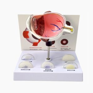 Fabricant ventes directes modèle d'oeil anatomique cataracte PVC matériel pour <span class=keywords><strong>ophtalmologie</strong></span> <span class=keywords><strong>collège</strong></span> médecin outils sciences médicales - Product Image 6