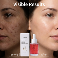 Sérum Visage Anti-Taches Marque Blanche Niacinamide 10% Acide Tranexamique 4% Correcteur de Pigmentation Essence Éclaircissante