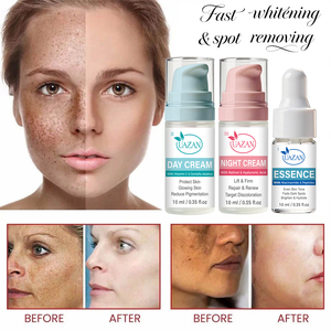 ครีมลดเลือนจุดด่างดำและเซรั่มลดจุดด่างดำสูตรไวท์เทนนิ่งเร็ว ชุดผลิตภัณฑ์ดูแลผิวหน้าไนอะซินาไมด์ วิตามินซี สำหรับขายส่ง (รับผลิตแบรนด์ส่วนตัว) - Product Image 1