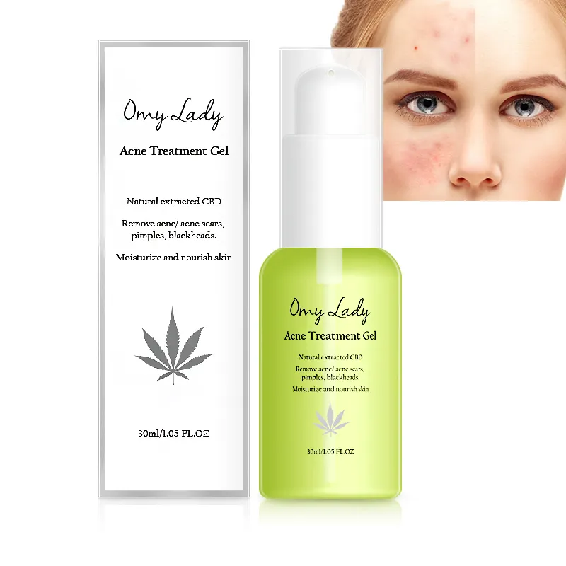 omy lady beauty products fast result 14 days effective aloe vera scented acne treatment gel