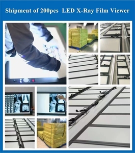 Medical Single Double Triple Vierfach <span class=keywords><strong>Digital</strong></span> LED Röntgen film Viewer Dimmbare Betrachtung lampe Negatos kop Preis - Product Image 4
